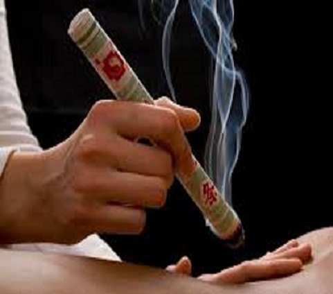 Moxibustion Basica - Thaizen
