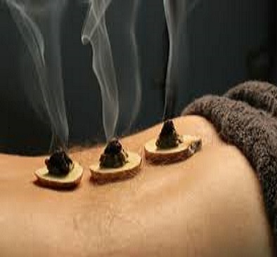 Moxibustion Avanzada - Thaizen